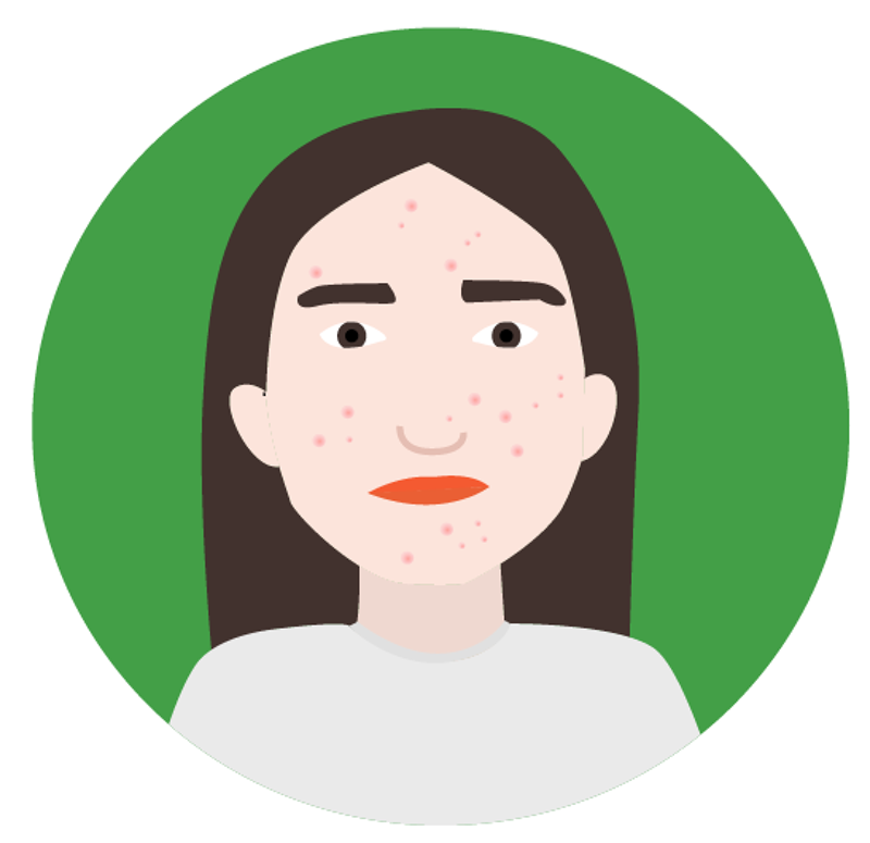 CBG Öl für die Haut